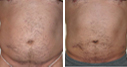 Before & After Photos